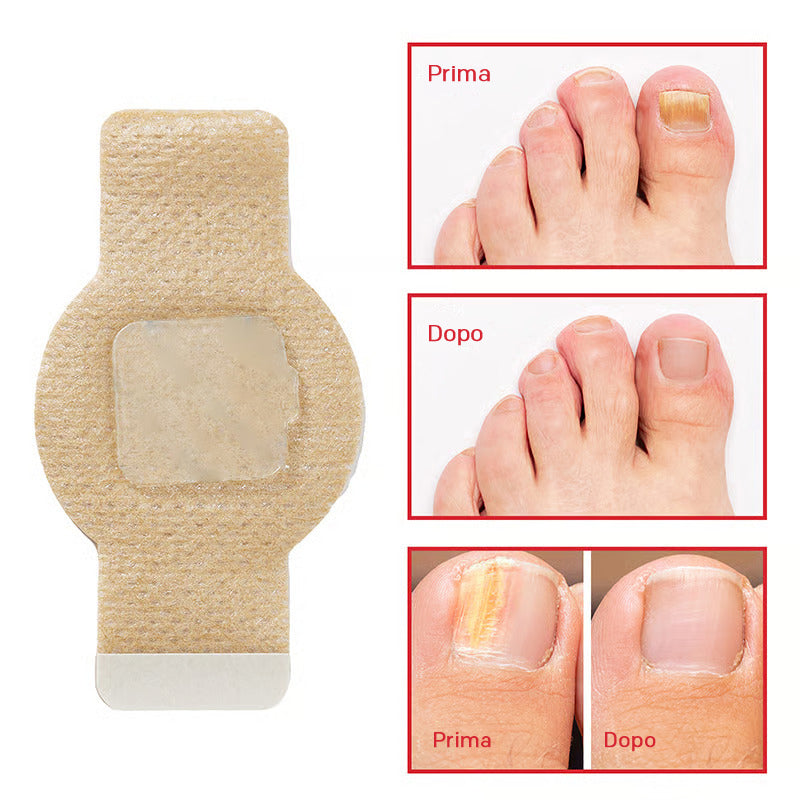 VeraNail™ — Clear, Confident Nails That Let You Bare Your Feet Proudly