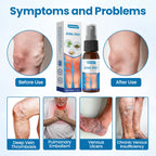 VeinRenu™ — Effortless Relief and Stunning Legs You’ll Love to Show Off (1+1 FREE TODAY!)