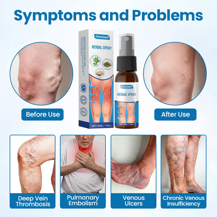 VeinRenu™ — Effortless Relief and Stunning Legs You’ll Love to Show Off (1+1 FREE TODAY!)