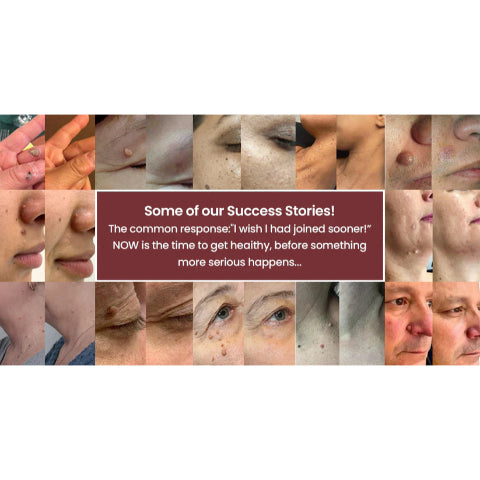 DermiClear™ — Erase Skin Flaws Fast for Smooth, Radiant Confidence
