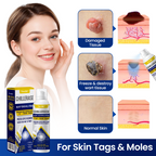 FrostMist™ — Chill Away Bumps and Unleash Silky, Touchable Skin Fast