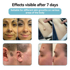 LumaClear™ — Precision Laser Power to Unleash Your Most Radiant, Confident Skin
