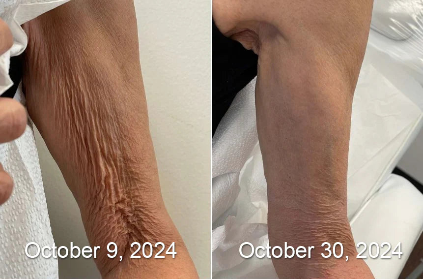 VeloraMist™ — Melt Away Pain and Glow with Youthful, Soothing Relief