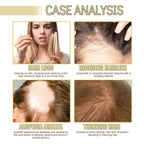 RamaraBoost™ — Unlock Lush, Head-Turning Hair That Radiates Confidence