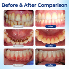 VivaDerm™ Oral Repair Elixir — Heal Your Gums Fast for a Pain-Free, Confident Smile