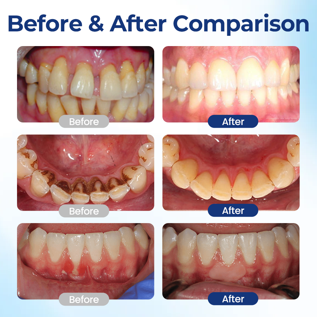 VivaDerm™ Oral Repair Elixir — Heal Your Gums Fast for a Pain-Free, Confident Smile