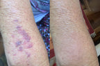 VeloraMist™ — Melt Away Pain and Glow with Youthful, Soothing Relief