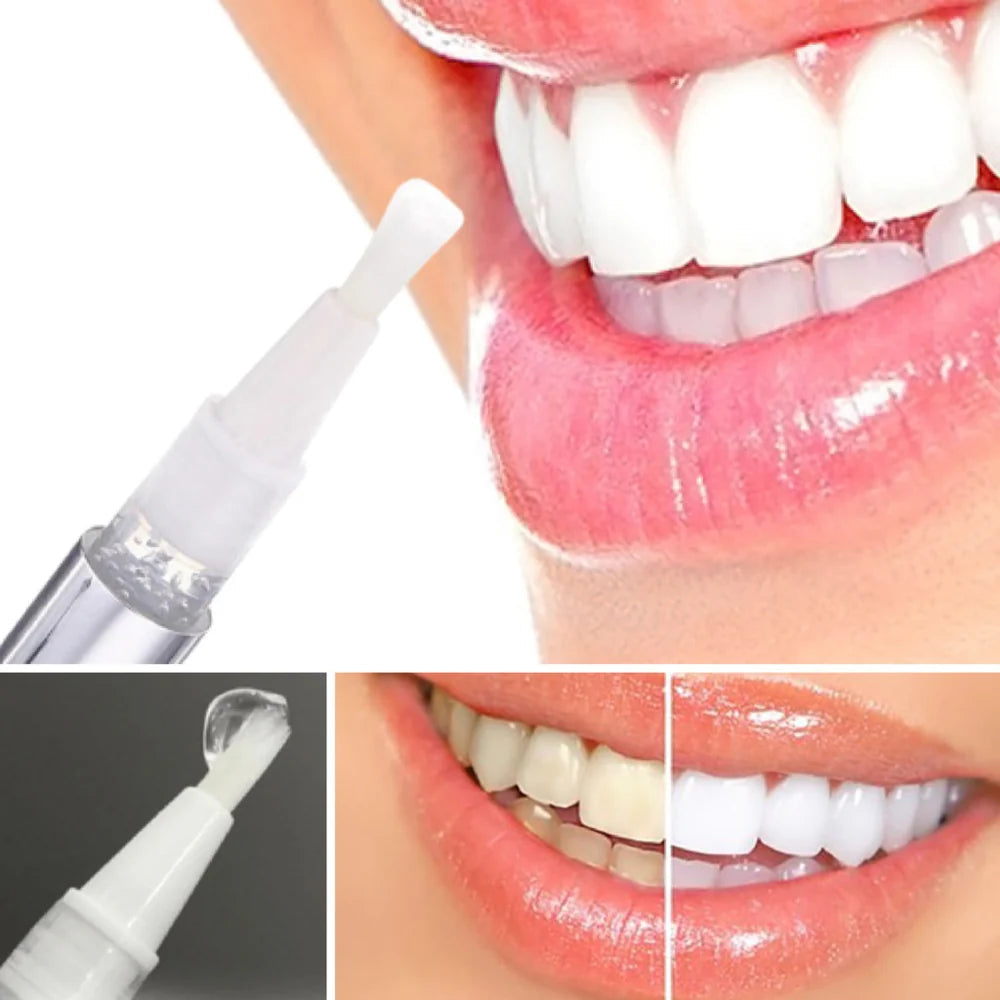 RadianceSwipe™ Whitening Pen — Unleash a Dazzling Smile That Commands Attention Instantly