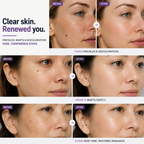 LumaVera™ — Smooth Away Spots with Gentle, Precise Care You Can Trust