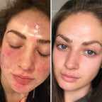 LumiClear™ Brightening Pads — Unleash Radiant Skin That Lights Up Your Confidence