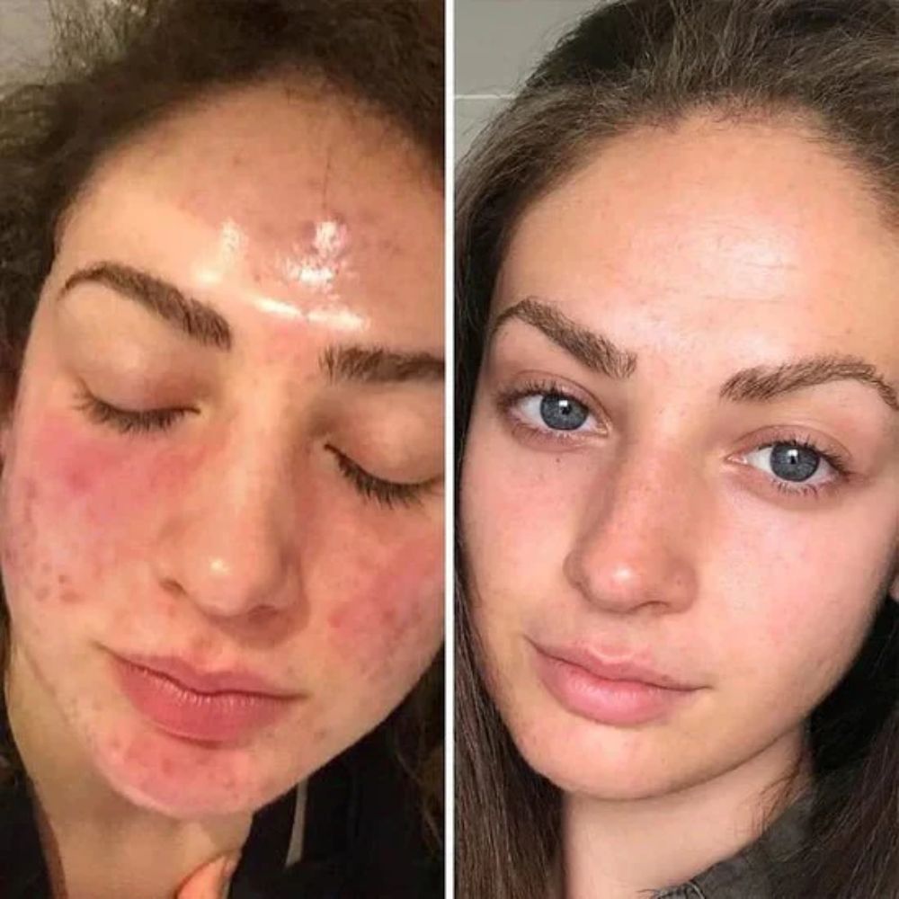 LumiClear™ Brightening Pads — Unleash Radiant Skin That Lights Up Your Confidence