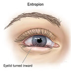 OpenEyes™ — Wake Up to Brighter, Smoother, More Refreshed-Looking Eyes Every Day