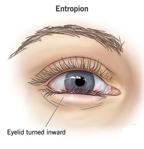OpenEyes™ — Wake Up to Brighter, Smoother, More Refreshed-Looking Eyes Every Day