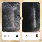 VividRoot™ Precision Pen — Instantly Reclaim a Youthful, Radiant You