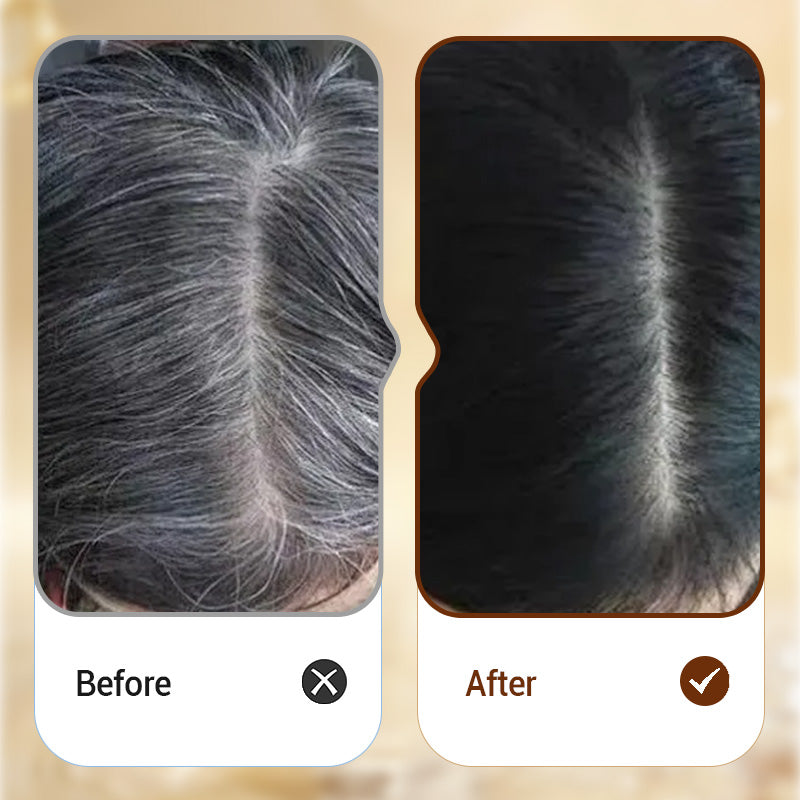 VividRoot™ Precision Pen — Instantly Reclaim a Youthful, Radiant You