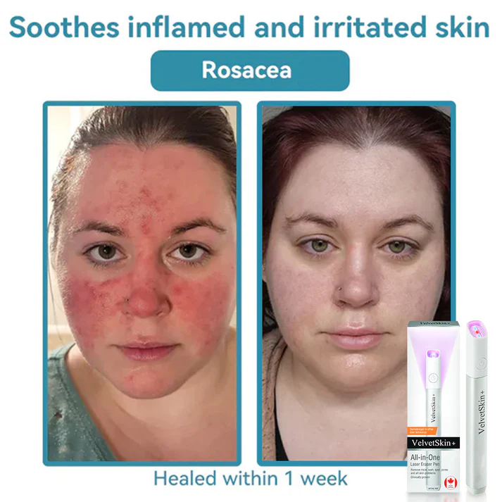 LumaClear™ — Precision Laser Power to Unleash Your Most Radiant, Confident Skin