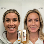 BrilloraGlow™ — Instantly Lift, Smooth, and Renew Your Youthful Glow