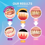 CrispSmile™ — Instantly Reveal a Radiant, Silky-Smooth Smile That Stops Crowds Cold