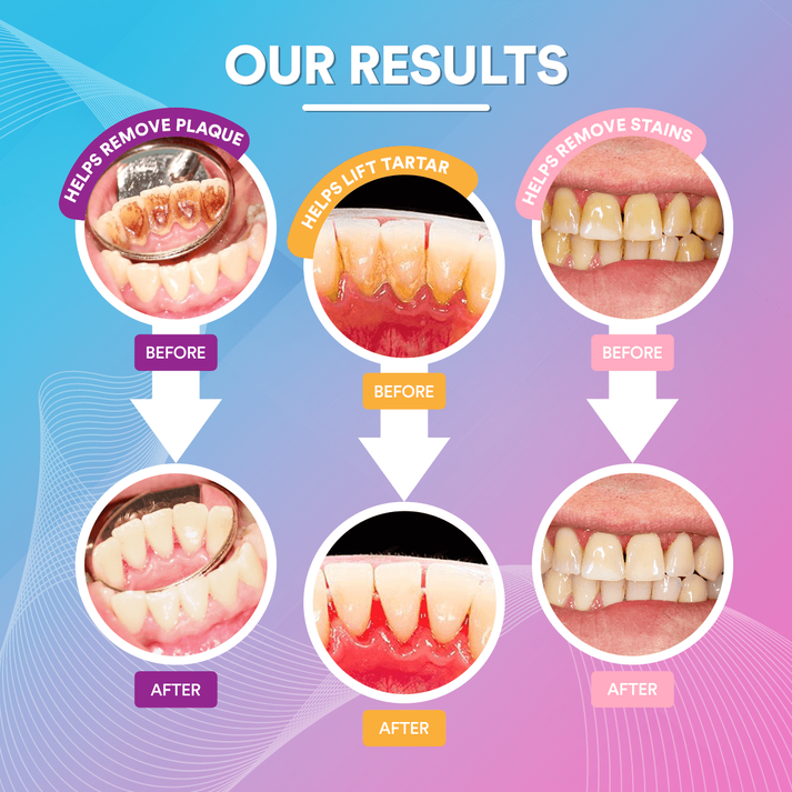 CrispSmile™ — Instantly Reveal a Radiant, Silky-Smooth Smile That Stops Crowds Cold