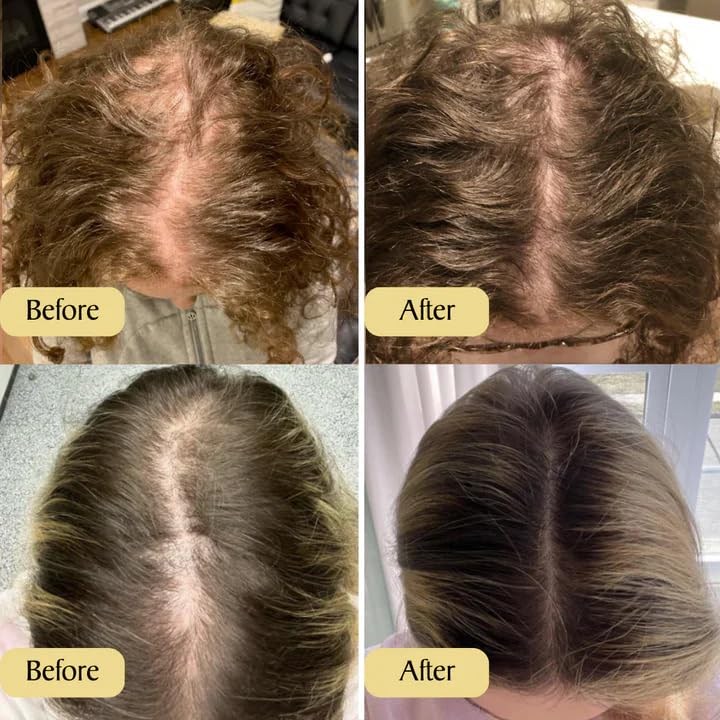 RamaraBoost™ — Unlock Lush, Head-Turning Hair That Radiates Confidence