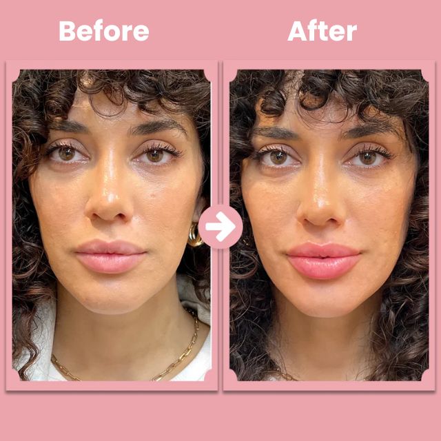PlumpAura™ — Ignite Natural Fullness for Soft, Irresistible Lips Every Day