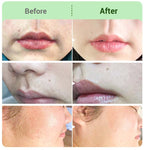 VelvaSilk™ Hair Removal Kit — Finally, Smooth, Radiant Skin That Feels Like Freedom