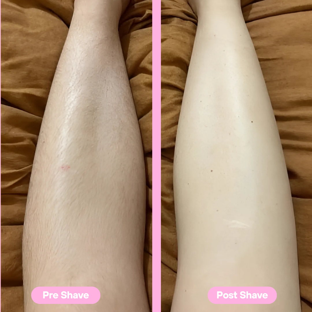 SilkMira™ — Unlock Silky Skin That Feels Like Pure Confidence