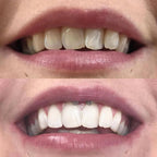 RadianceSwipe™ Whitening Pen — Unleash a Dazzling Smile That Commands Attention Instantly