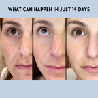 VivaLuxe™ Lift Strips — Instantly Reveal Firmer, Younger Skin That Radiates Confidence