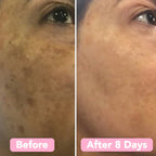 TurmeriLuxe™ — Unlock Your Skin’s Calm, Clear, and Radiant Glow Every Day