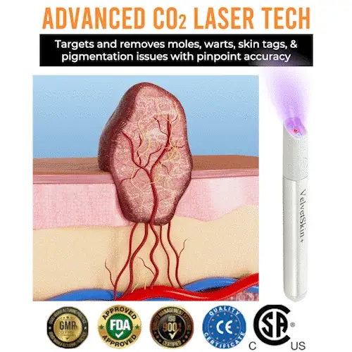 LumaClear™ — Precision Laser Power to Unleash Your Most Radiant, Confident Skin
