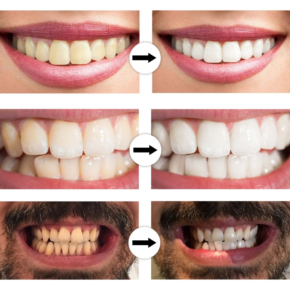 LumoBright™ — Unlock a Radiant Smile That Turns Heads Instantly