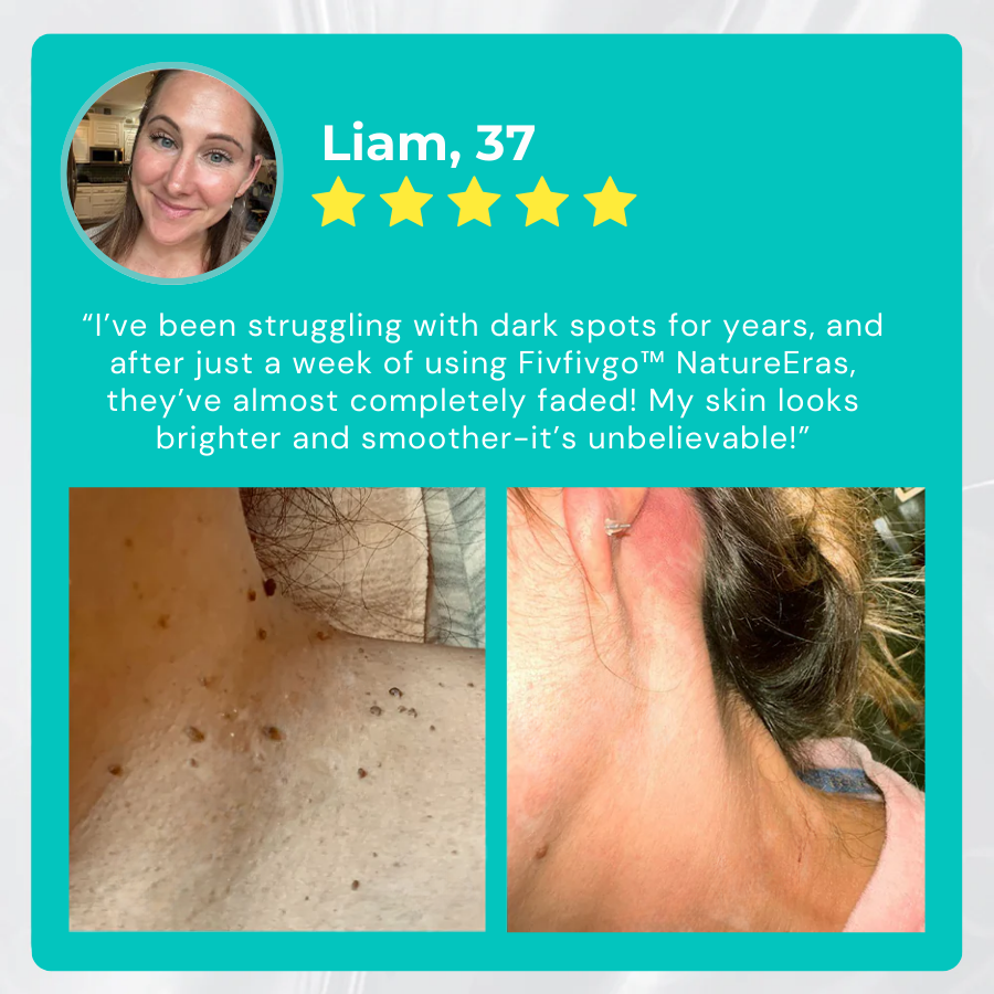 GlowAura™ — Reveal Smooth, Radiant Skin That Brings Your Confidence Back Fast