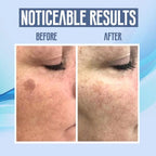 LumiClear™ Skin Pen — Reveal Smooth, Spotless Skin and Boost Your Confidence Instantly