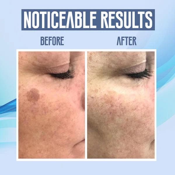 LumiClear™ Skin Pen — Reveal Smooth, Spotless Skin and Boost Your Confidence Instantly