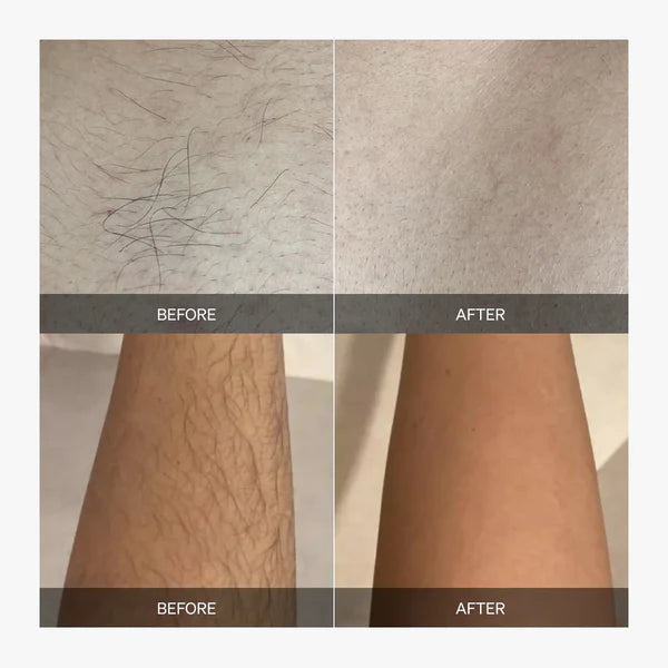 LumiSilk™ — Experience Effortless, Radiant Smoothness That Lasts for Weeks