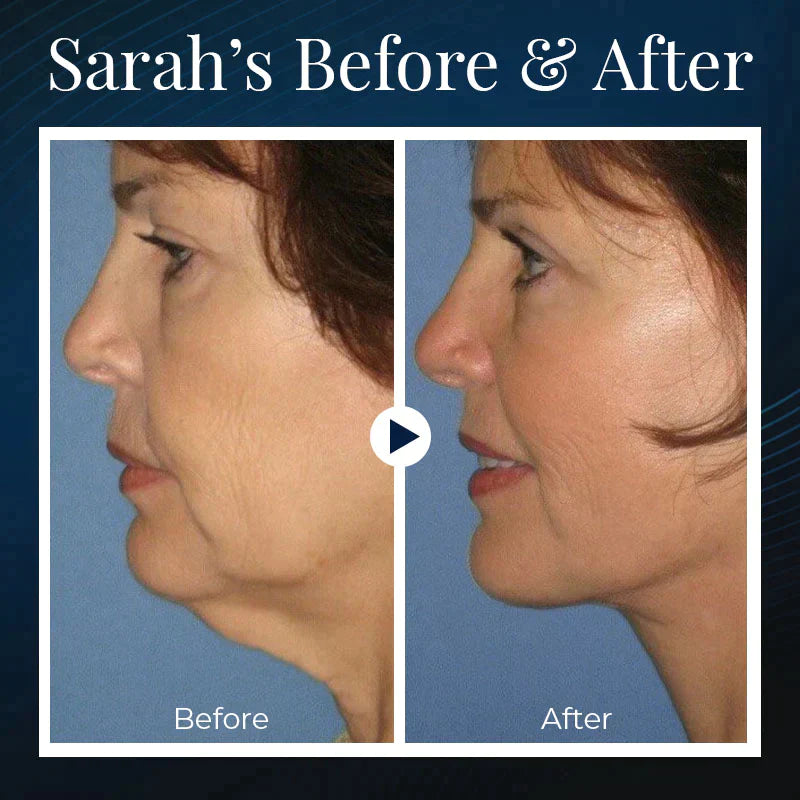 VivaLift™ — Wake Up to a Naturally Sculpted, Youthful Jawline Without Effort