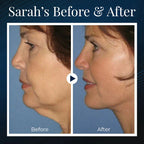 JawSculpt™ — Wake Up with a Firmer, Jaw-Dropping Contour Every Day