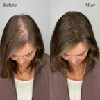 RamoraRoot™ — Unlock Thick, Lush Hair That Feels Alive and Strong Every Day