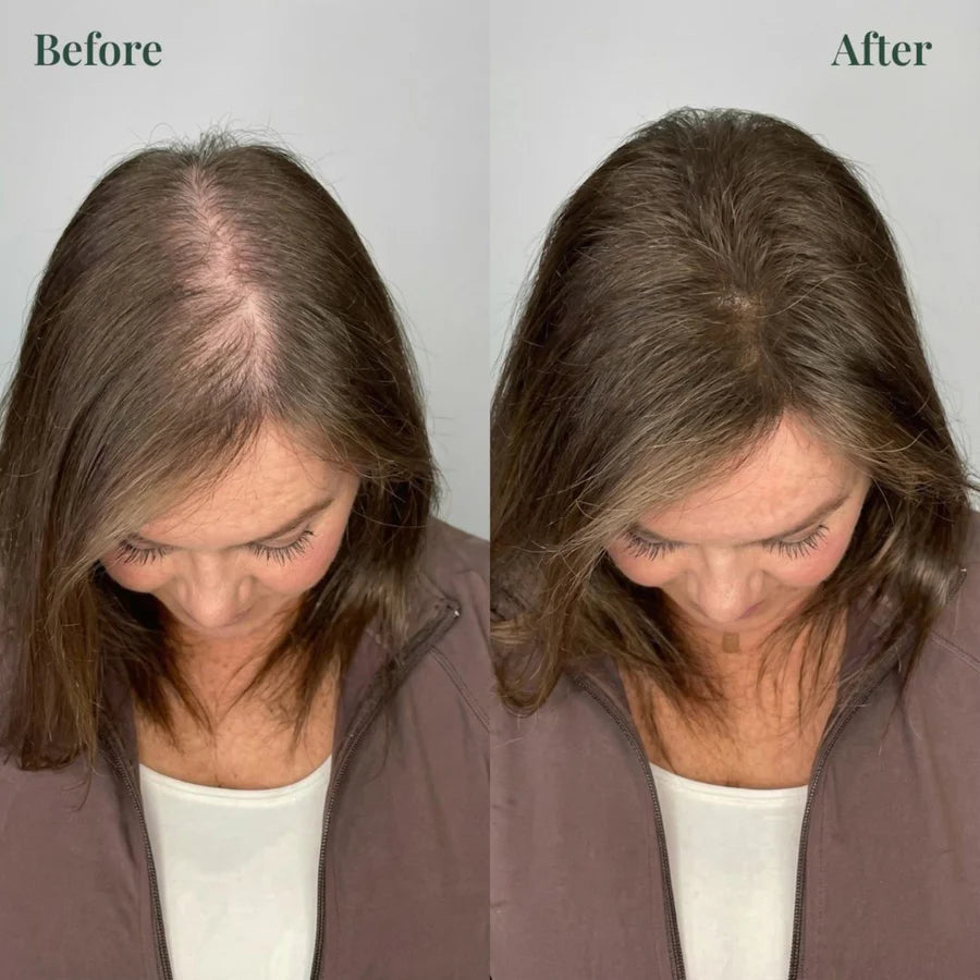 RamoraRoot™ — Unlock Thick, Lush Hair That Feels Alive and Strong Every Day