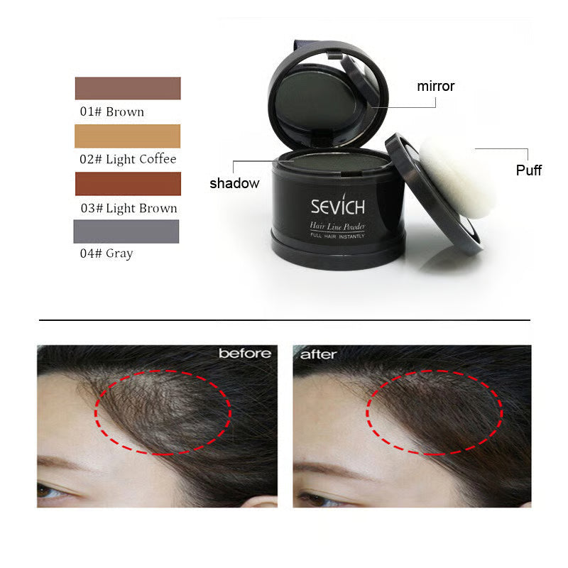 VivaRoot™ — Instantly Transform Your Hairline and Own Every Room
