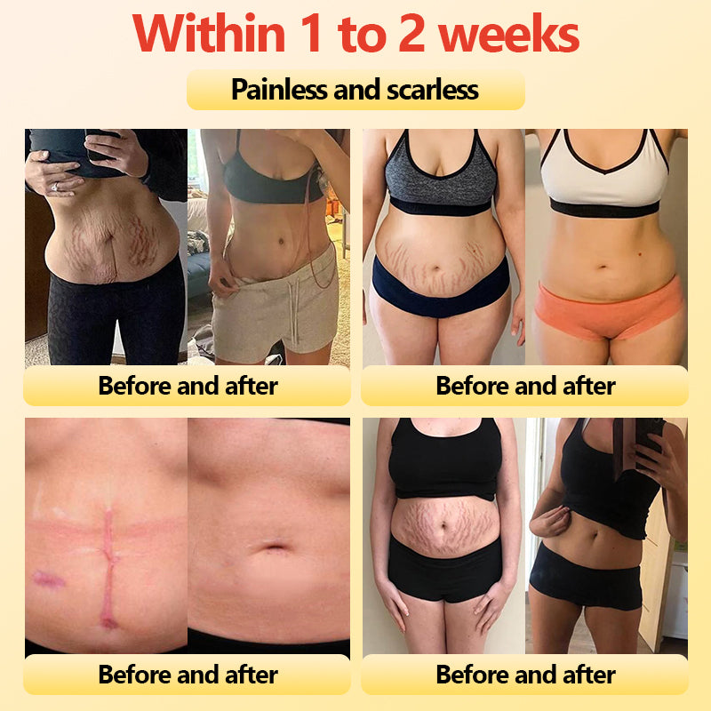 LumiThera™ — Feel the Deep Heat That Melts Fat, Calms Pain, and Reveals Radiant Skin