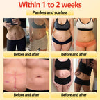 LumiThera™ — Feel the Deep Heat That Melts Fat, Calms Pain, and Reveals Radiant Skin