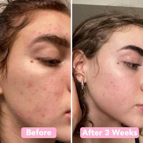 GlowLuxe™ — Wake Up to Radiant, Spot-Free Skin Every Day