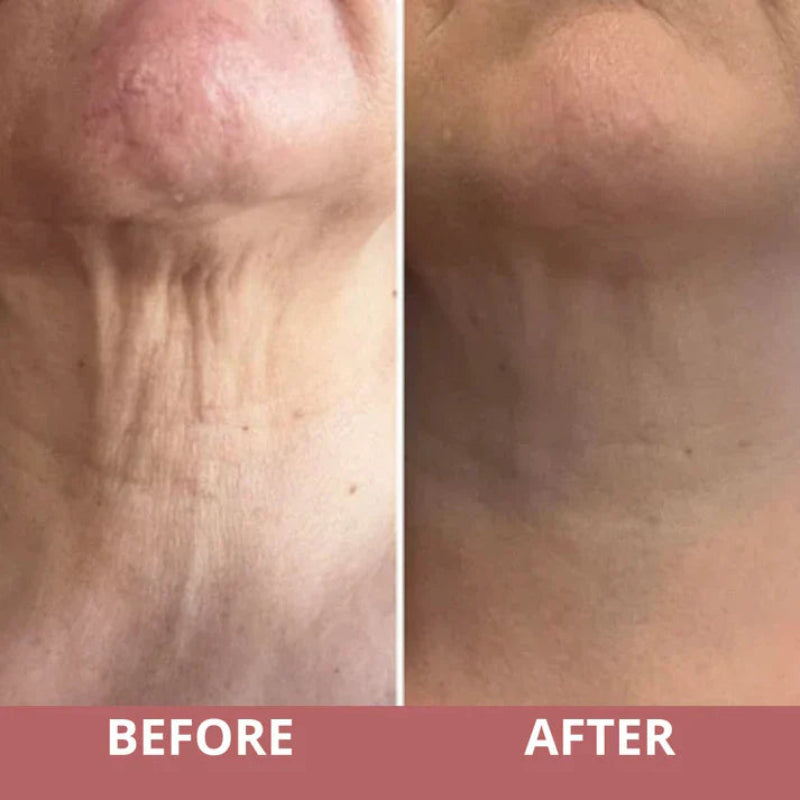 RadianceLift™ — Sculpt Your Neck Into a Stunning, Youthful Masterpiece