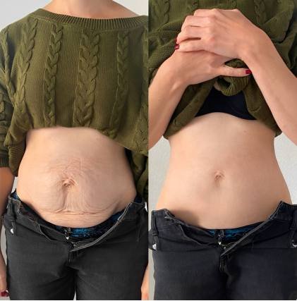 VeloraMist™ — Melt Away Pain and Glow with Youthful, Soothing Relief