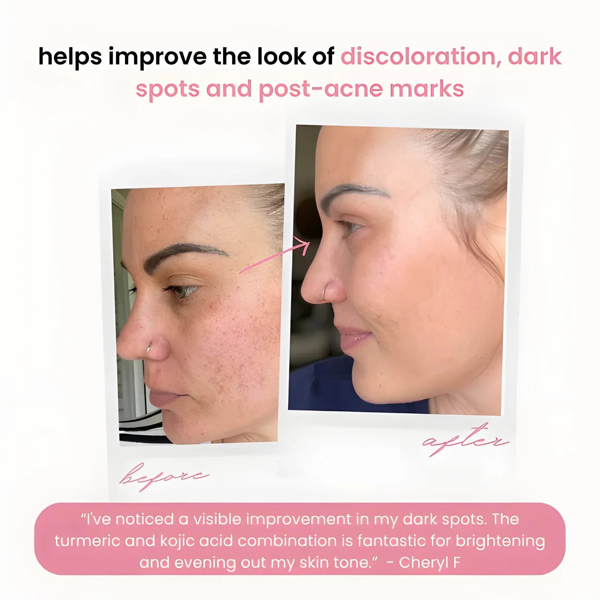 RamoraBright™ — Reveal Your Radiant Glow by Fading Dark Spots Fast
