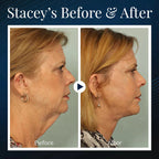 JawSculpt™ — Wake Up with a Firmer, Jaw-Dropping Contour Every Day