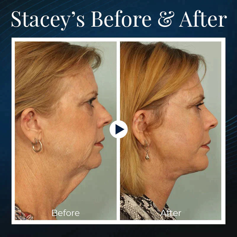 JawSculpt™ — Wake Up with a Firmer, Jaw-Dropping Contour Every Day