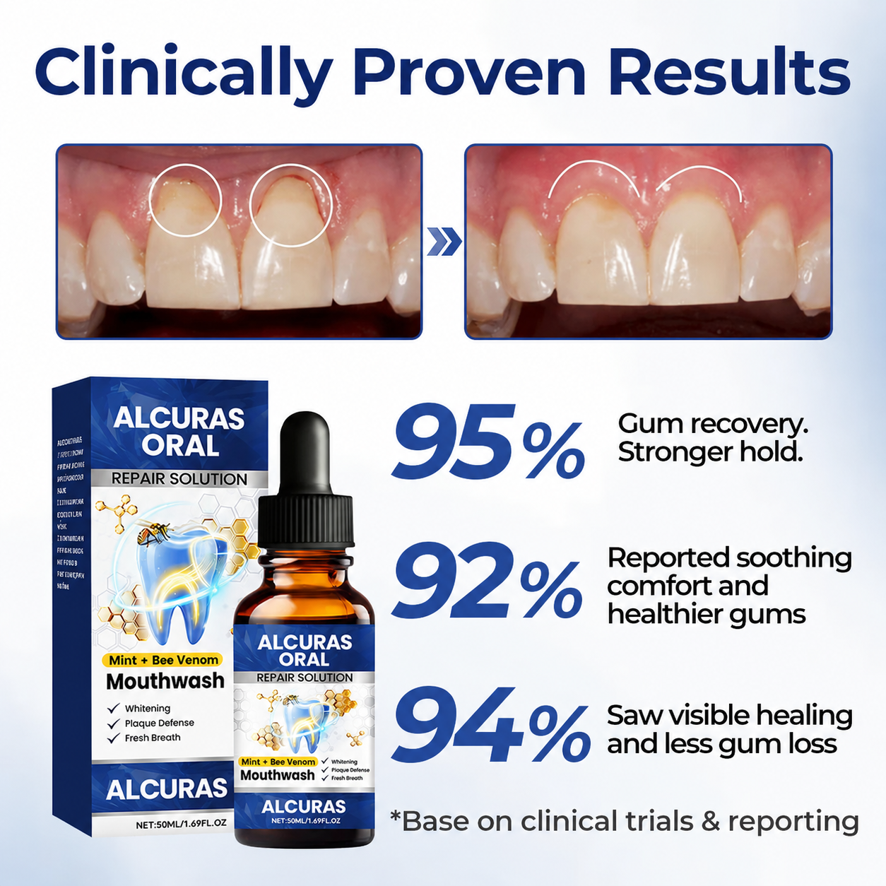 VivaDerm™ Oral Repair Elixir — Heal Your Gums Fast for a Pain-Free, Confident Smile